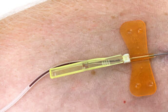 Kinder mit Hämophilie A vertraut machen